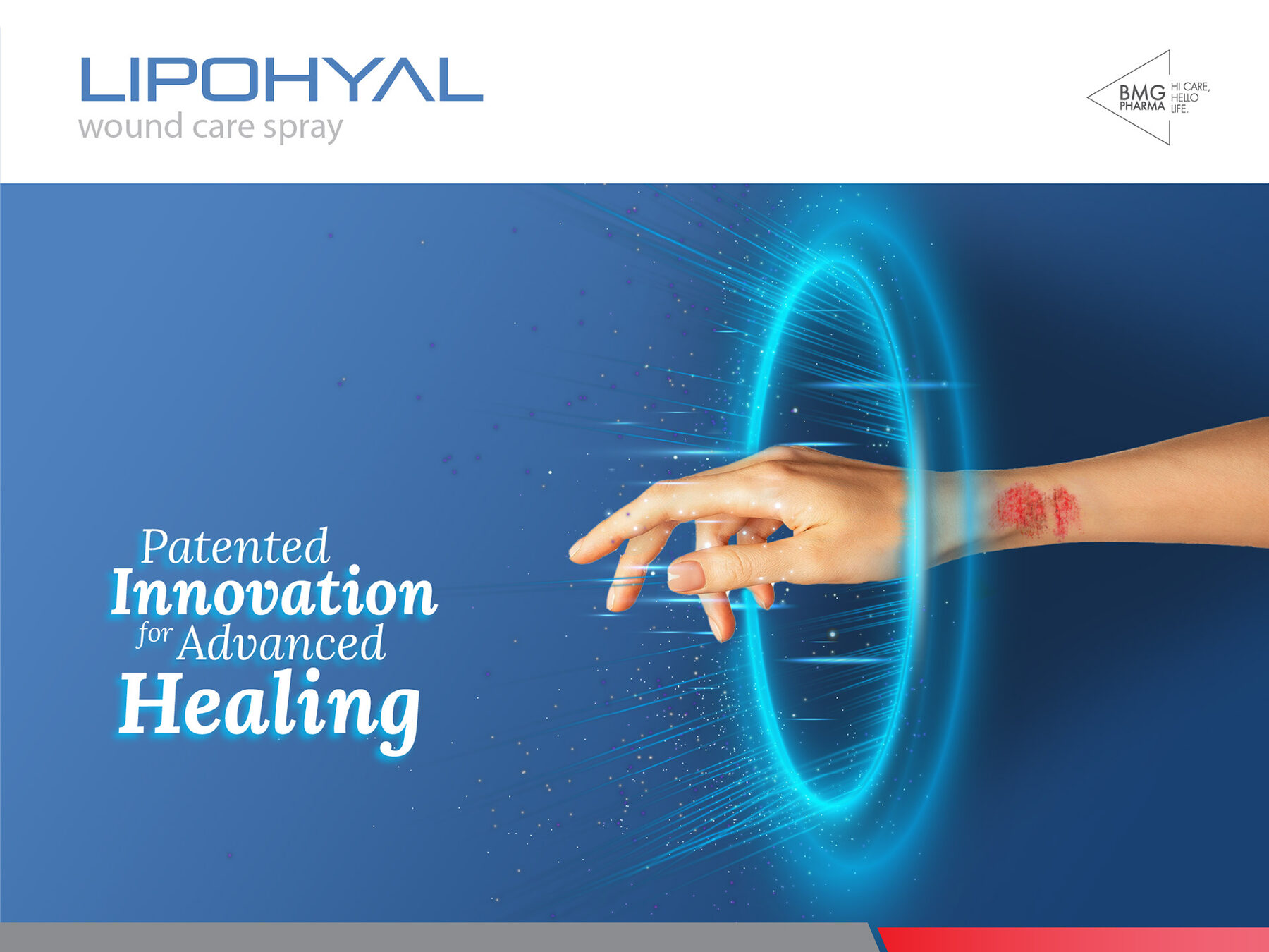 Lipohyal